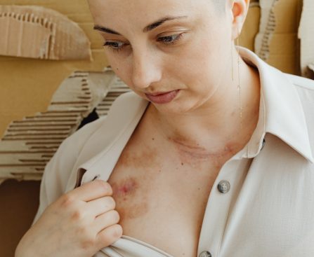 "Decoding Neoplasm Uncertainty: Cancer or Not?