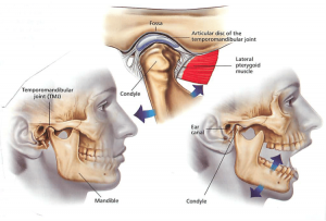 TEMPOROMANDIBULAR JOINT (TMJ) DISORDERS