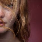 PIGMENTATION SOLUTION: BRIGHTER SKIN AWAITS