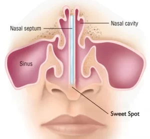 A HEALTHY GUIDE TO SEPTUM PIERCING AFTERCARE AND MAINTENANCE