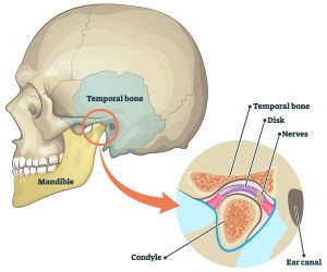 TEMPOROMANDIBULAR JOINT (TMJ) DISORDERS