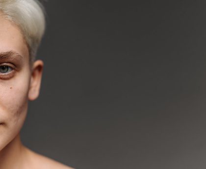 GRAY HAIR MYTH: PLUCKING DOES NOT CAUSES MORE